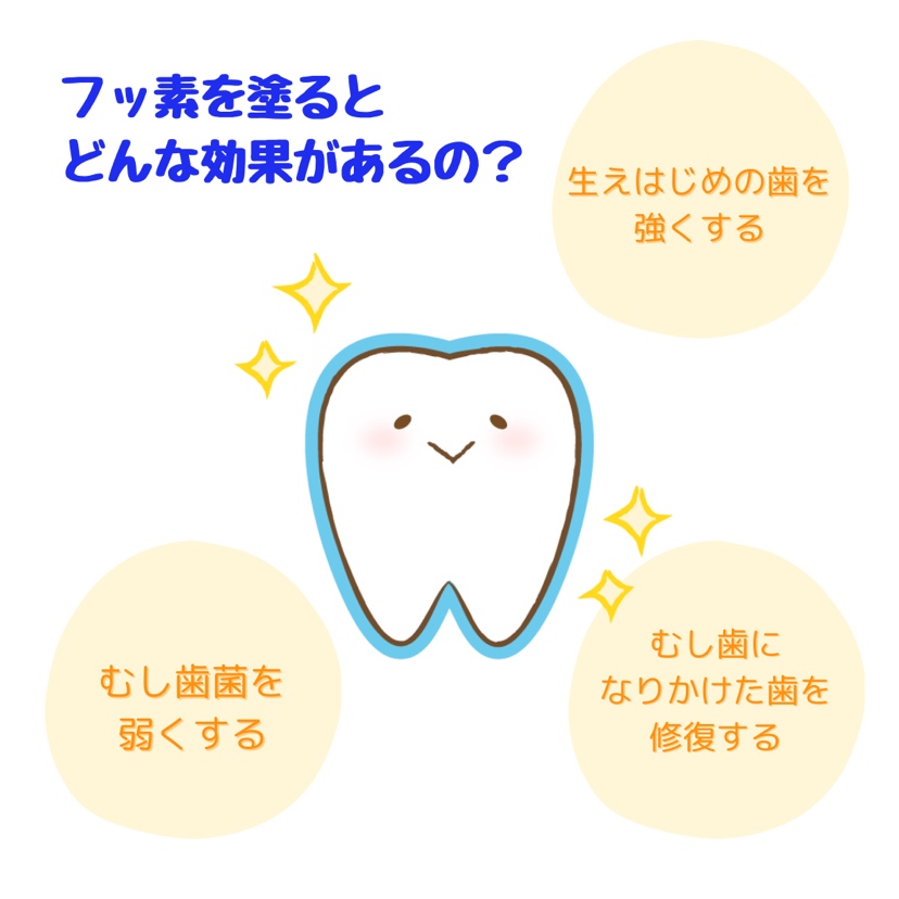 当院は京都市フッ化物歯面塗布事業の指定医療機関です