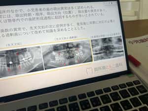 子どもの咬合を考える会例会で発表しました