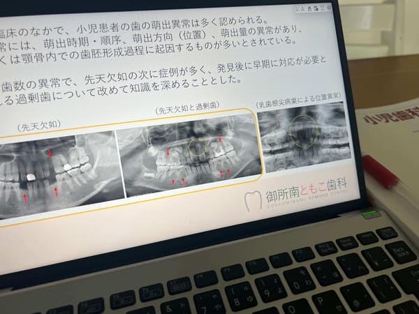 子どもの咬合を考える会例会で発表しました